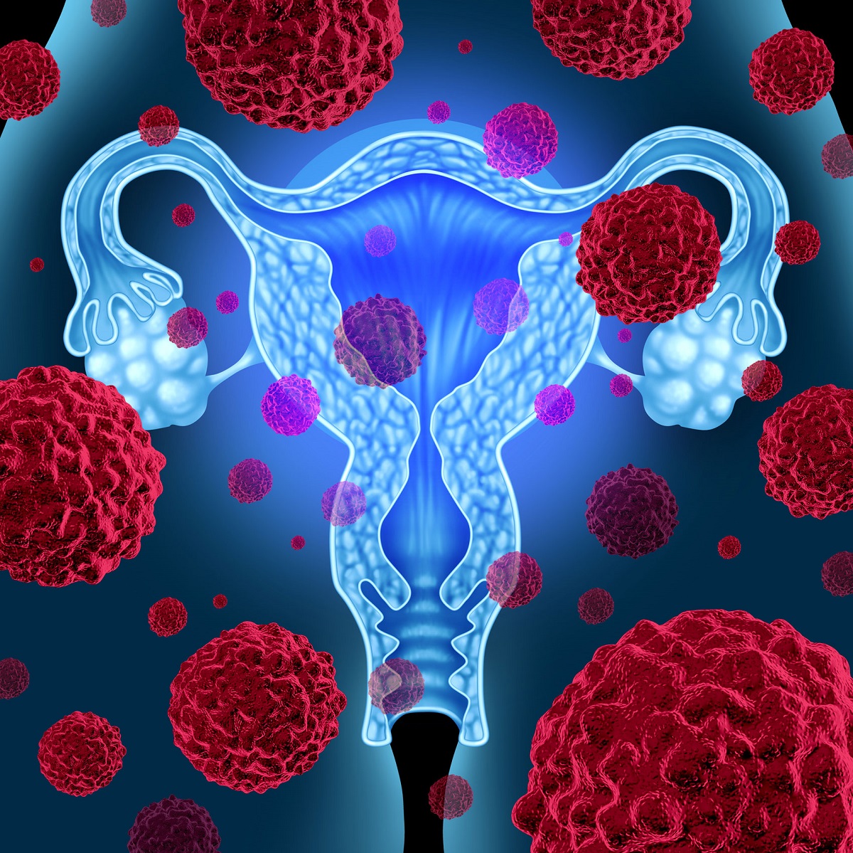 Uno studio del Cnr scopre il processo a cascata alla base dell’invasione metastatica del carcinoma ovarico e della formazione di invadopodi, che coinvolge il recettore dell’endotelina e della b-arrestina1