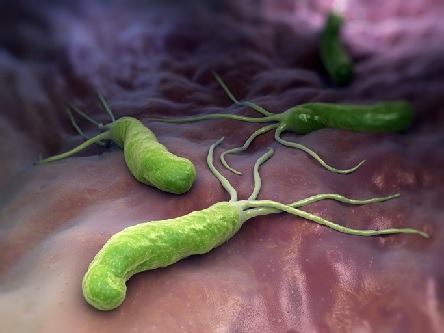 Helicobacter pylori: una singola capsula che contiene sali di bismuto, tetraciclina e metronidazolo è efficace nell'eradicazione dell'infezione