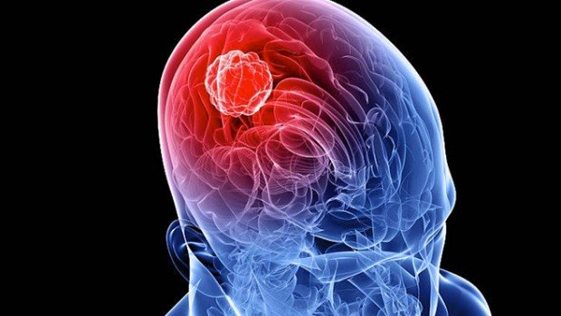 Nel 2019 in Toscana 13 i casi di meningite, sono 122 dal 2015. L'ultimo è quello di un 13enne ricoverato al Meyer la sera di Natale