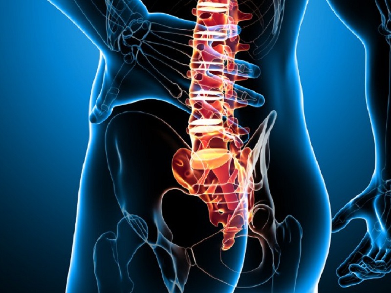 Spondiloartrite assiale non radiografica: ixekizumab può avere effetti positivi sull'articolazione sacroiliaca secondo un'analisi dei dati di imaging dello studio COAST-X