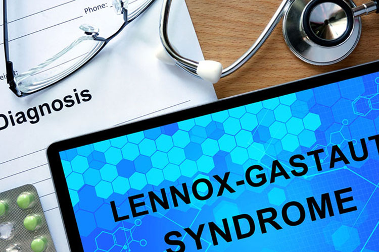 Pazienti con sindrome di Lennox-Gastaut hanno sperimentato una significativa riduzione delle crisi epilettiche mediante trattamento con fenfluramina