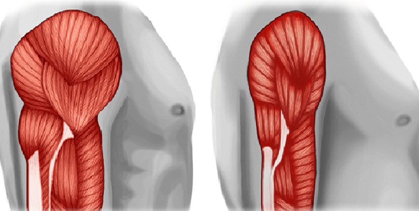 La sarcopenia, condizione di riduzione della massa muscolare, può favorire le complicanze da Covid secondo uno studio italiano