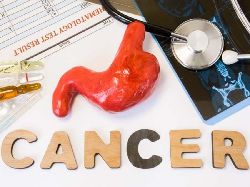 L'isoforma 2 della proteina claudina-18 (CLDN18.2) è un biomarcatore espresso in circa il 35-40% dei pazienti con adenocarcinoma gastrico o della giunzione gastroesofagea